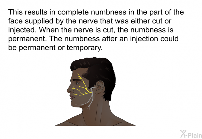 This results in complete numbness in the part of the face supplied by the nerve that was either cut or injected. When the nerve is cut, the numbness is permanent. The numbness after an injection could be permanent or temporary.