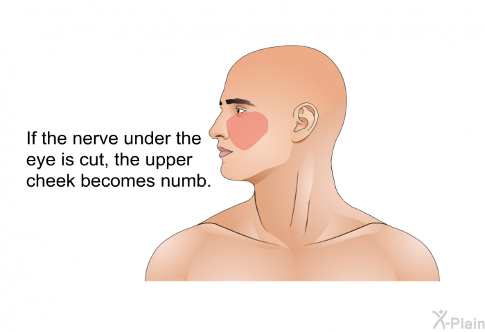 If the nerve under the eye is cut, the upper cheek becomes numb.