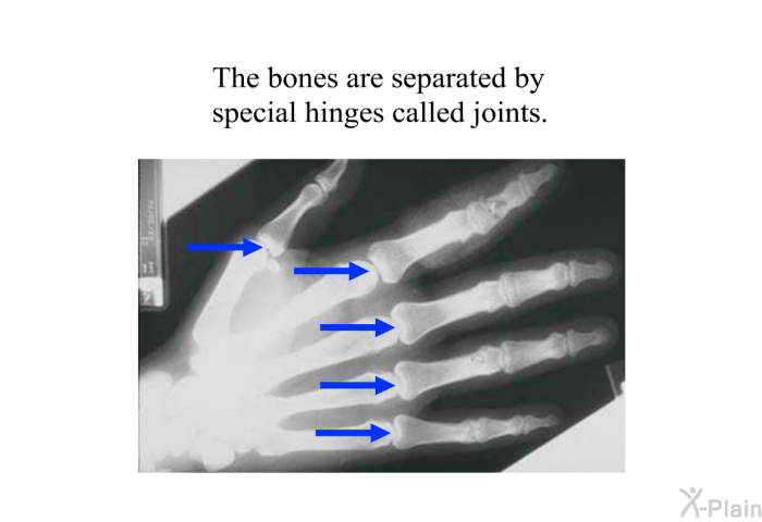 The bones are separated by special hinges called joints.