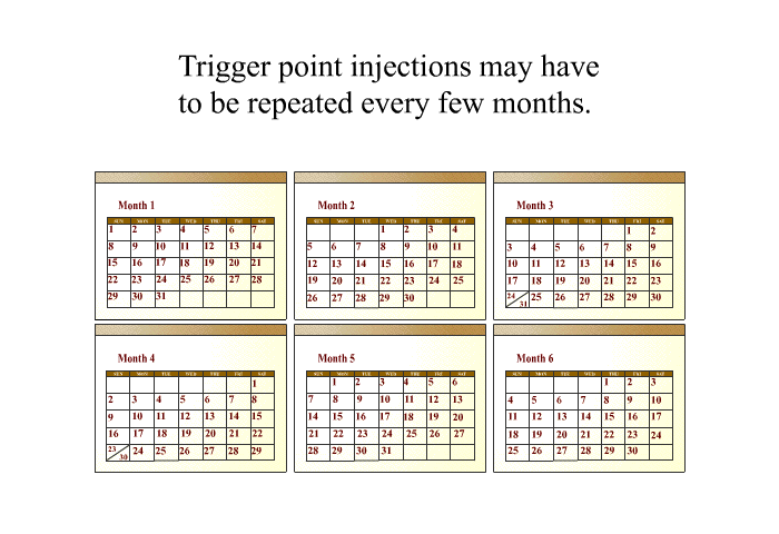 Trigger point injections may have to be repeated every few months.
