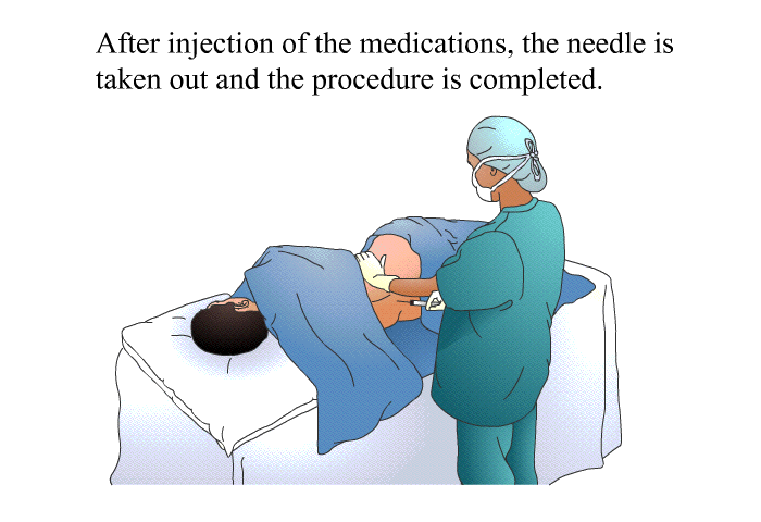 After injection of the medications, the needle is taken out and the procedure is completed.