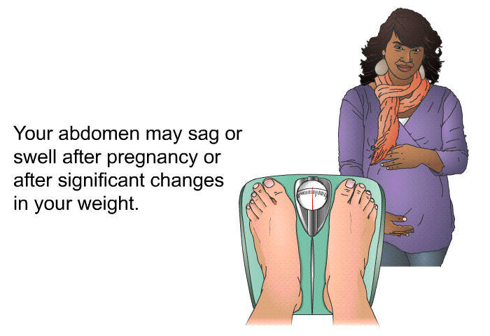 Your abdomen may sag or swell after pregnancy or after significant changes in your weight.