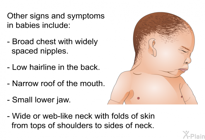 Other signs and symptoms in babies include:  Broad chest with widely spaced nipples. Low hairline in the back. Narrow roof of the mouth. Small lower jaw. Wide or web-like neck with folds of skin from tops of shoulders to sides of neck.
