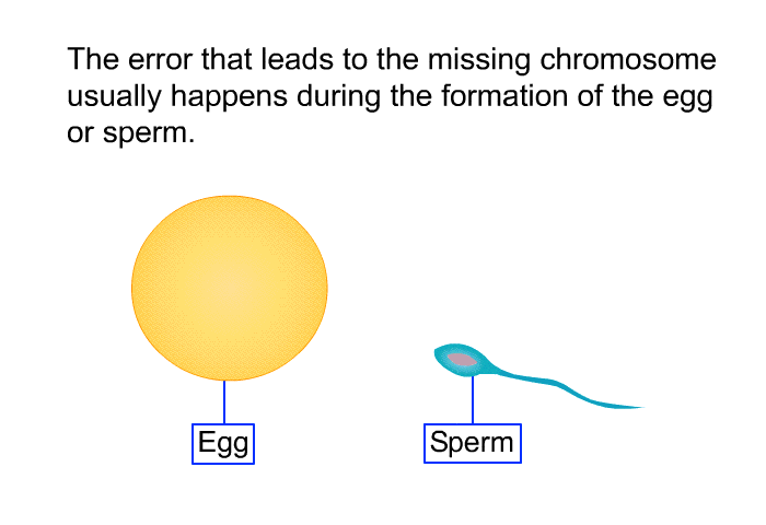 The error that leads to the missing chromosome usually happens during the formation of the egg or sperm.