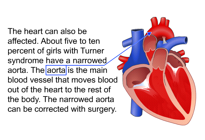 The heart can also be affected. About five to ten percent of girls with Turner syndrome have a narrowed aorta. The aorta is the main blood vessel that moves blood out of the heart to the rest of the body. The narrowed aorta can be corrected with surgery.