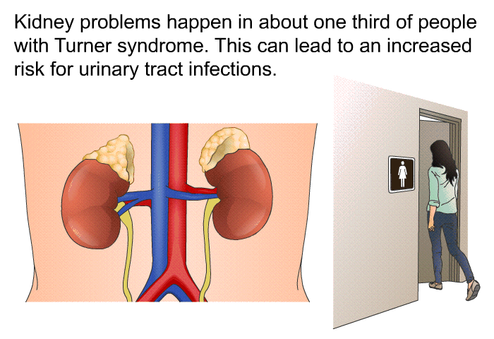 Kidney problems happen in about one third of people with Turner syndrome. This can lead to an increased risk for urinary tract infections.