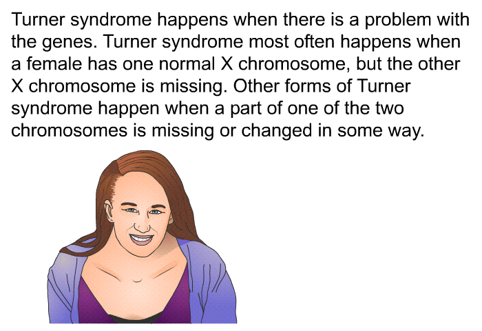 Turner syndrome happens when there is a problem with the genes. Turner syndrome most often happens when a female has one normal X chromosome, but the other X chromosome is missing. Other forms of Turner syndrome happen when a part of one of the two chromosomes is missing or changed in some way.