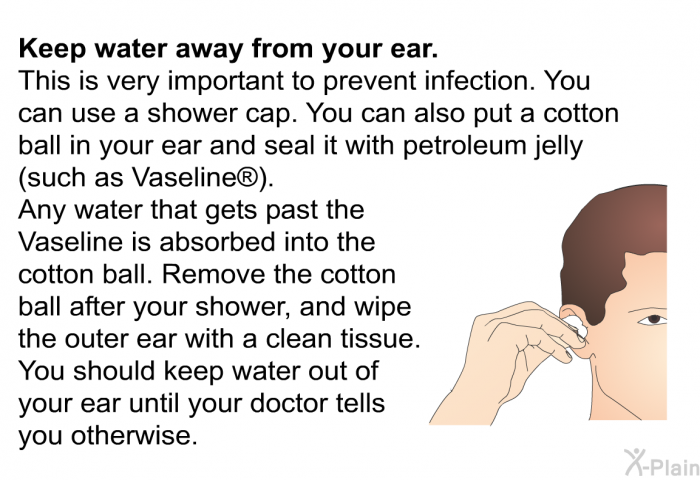 <B>Keep water away from your ear.</B>
This is very important to prevent infection. You can use a shower cap. You can also put a cotton ball in your ear and seal it with petroleum jelly (such as Vaseline). Any water that gets past the Vaseline is absorbed into the cotton ball. Remove the cotton ball after your shower, and wipe the outer ear with a clean tissue. You should keep water out of your ear until your doctor tells you otherwise.