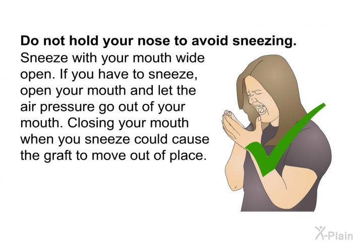 <B>Do not hold your nose to avoid sneezing</B>.
Sneeze with your mouth wide open. If you have to sneeze, open your mouth and let the air pressure go out of your mouth. Closing your mouth when you sneeze could cause the graft to move out of place.