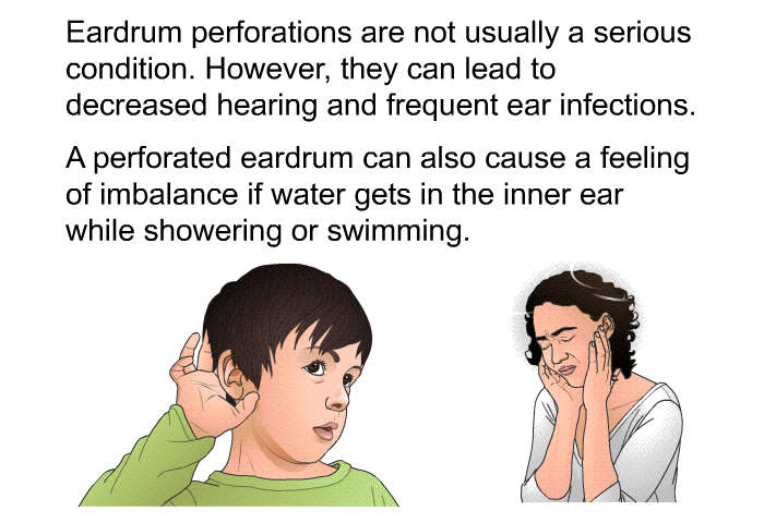 Eardrum perforations are not usually a serious condition. However, they can lead to decreased hearing and frequent ear infections. A perforated eardrum can also cause a feeling of imbalance if water gets in the inner ear while showering or swimming.