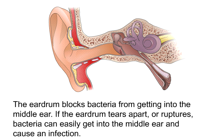The eardrum blocks bacteria from getting into the middle ear. If the eardrum tears apart, or ruptures, bacteria can easily get into the middle ear and cause an infection.