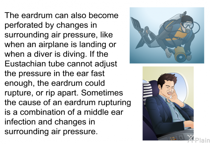 The eardrum can also become perforated by changes in surrounding air pressure, like when an airplane is landing or when a diver is diving. If the Eustachian tube cannot adjust the pressure in the ear fast enough, the eardrum could rupture, or rip apart. Sometimes the cause of an eardrum rupturing is a combination of a middle ear infection and changes in surrounding air pressure.