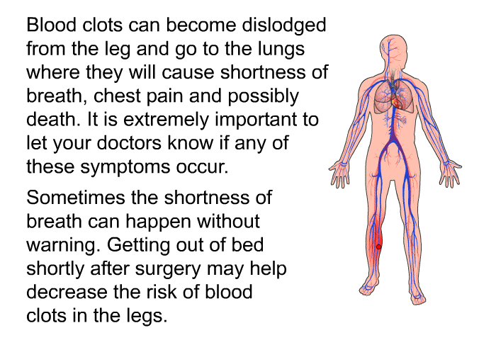 Blood clots can become dislodged from the leg and go to the lungs where they will cause shortness of breath, chest pain and possibly death. It is extremely important to let your doctors know if any of these symptoms occur. Sometimes the shortness of breath can happen without warning. Getting out of bed shortly after surgery may help decrease the risk of blood clots in the legs.