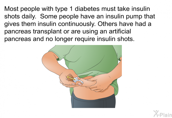 Most people with type 1 diabetes must take insulin shots daily. Some people have an insulin pump that gives them insulin continuously. Others have had a pancreas transplant or are using an artificial pancreas and no longer require insulin shots.