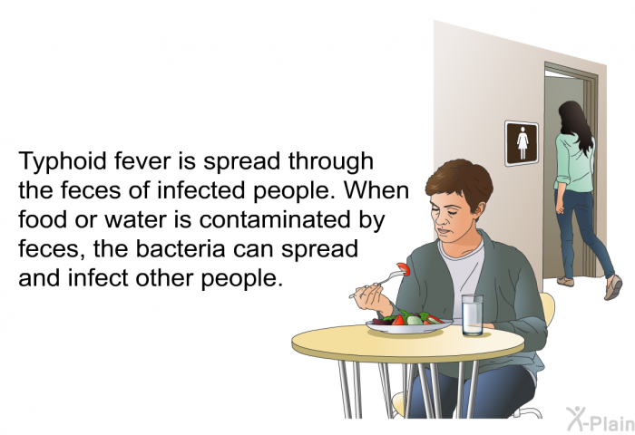Typhoid fever is spread through the feces of infected people. When food or water is contaminated by feces, the bacteria can spread and infect other people.