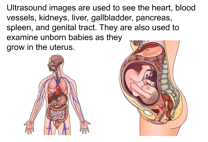 Ultrasound images are used to see the heart, blood vessels, kidneys, liver, gallbladder, pancreas, spleen, and genital tract. They are also used to examine unborn babies as they grow in the uterus.