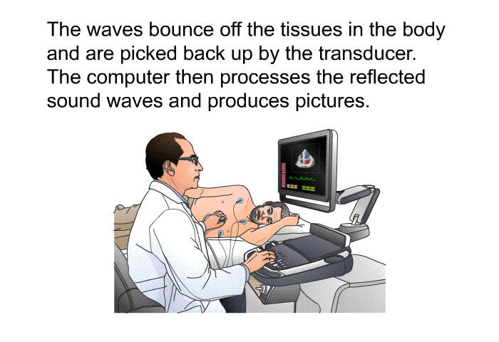 The waves bounce off the tissues in the body and are picked back up by the transducer. The computer then processes the reflected sound waves and produces pictures.