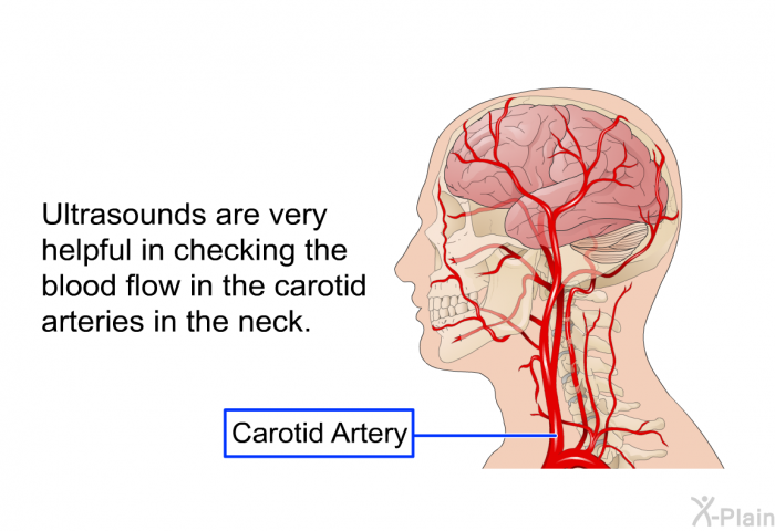 Ultrasounds are very helpful in checking the blood flow in the carotid arteries in the neck.