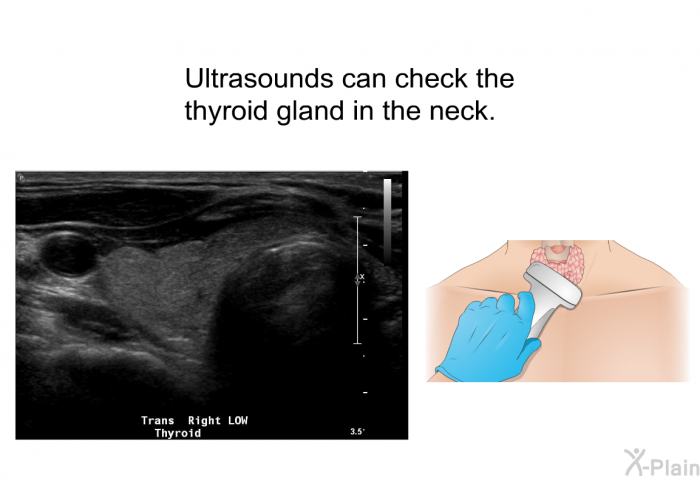 Ultrasounds can check the thyroid gland in the neck.