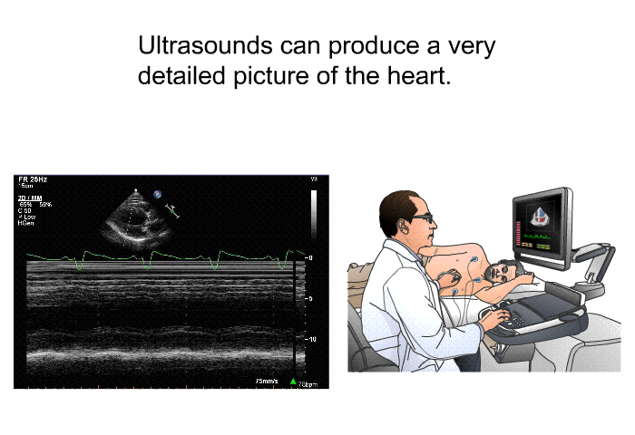 Ultrasounds can produce a very detailed picture of the heart.