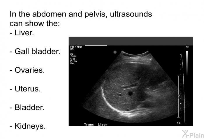 In the abdomen and pelvis, ultrasounds can show the:  Liver. Gall bladder. Ovaries. Uterus. Bladder. Kidneys.