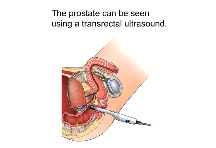 The prostate can be seen using a transrectal ultrasound.