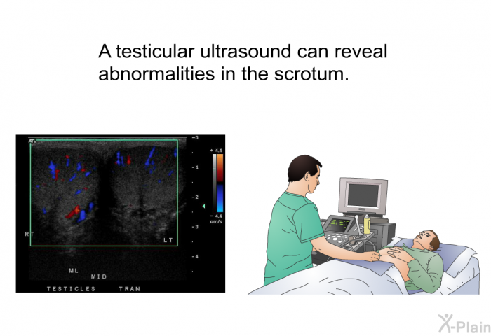 A testicular ultrasound can reveal abnormalities in the scrotum.