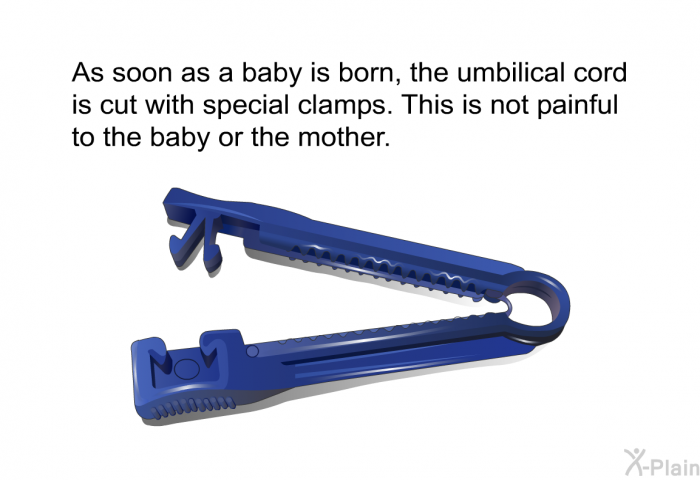 As soon as a baby is born, the umbilical cord is cut with special clamps. This is not painful to the baby or the mother.