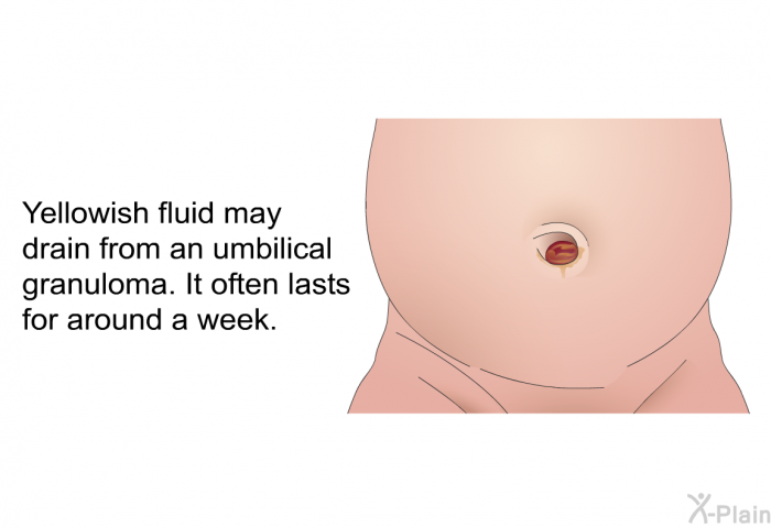 Yellowish fluid may drain from an umbilical granuloma. It often lasts for around a week.