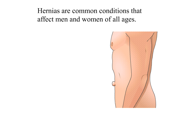 Hernias are common conditions that affect men and women of all ages.