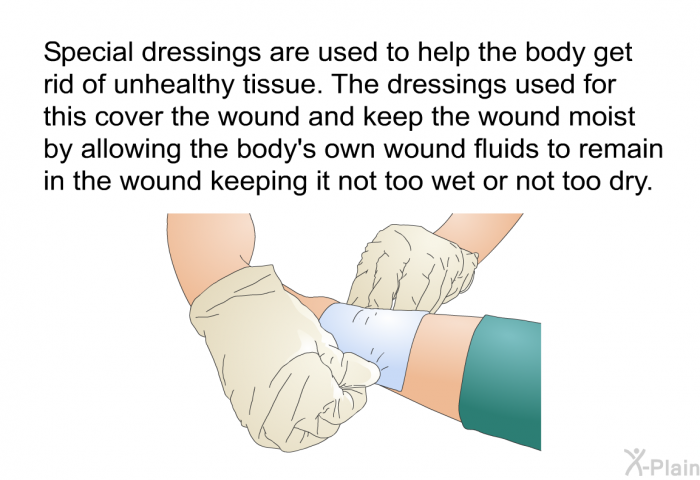 Special dressings are used to help the body get rid of unhealthy tissue. The dressings used for this cover the wound and keep the wound moist by allowing the body's own wound fluids to remain in the wound keeping it not too wet or not too dry.