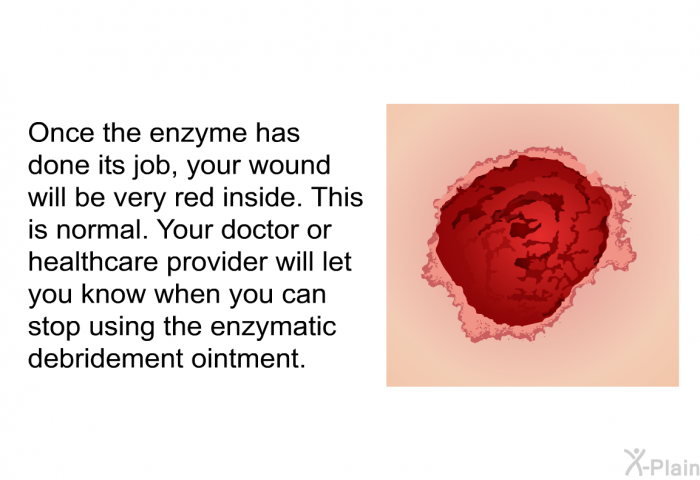 Once the enzyme has done its job, your wound will be very red inside. This is normal. Your doctor or healthcare provider will let you know when you can stop using the enzymatic debridement ointment.
