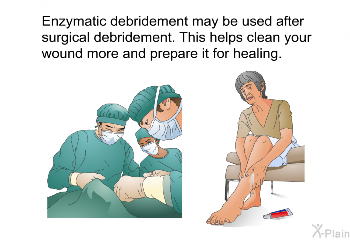 Enzymatic debridement may be used after surgical debridement. This helps clean your wound more and prepare it for healing.