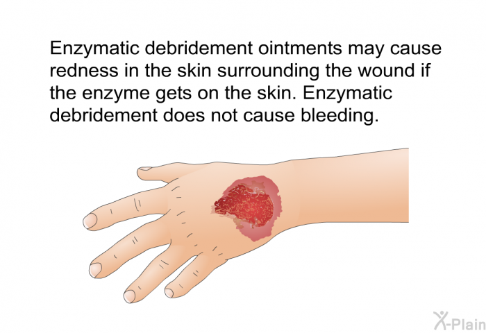 Enzymatic debridement ointments may cause redness in the skin surrounding the wound if the enzyme gets on the skin. Enzymatic debridement does not cause bleeding.