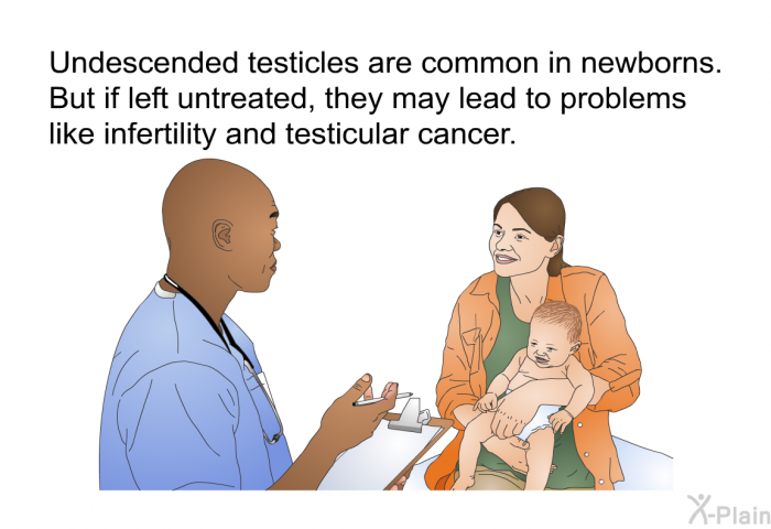 Undescended testicles are common in newborns. But if left untreated, they may lead to problems like infertility and testicular cancer.