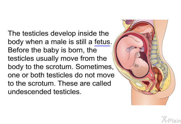The testicles develop inside the body when a male is still a fetus. Before the baby is born, the testicles usually move from the body to the scrotum. Sometimes, one or both testicles do not move to the scrotum. These are called undescended testicles.