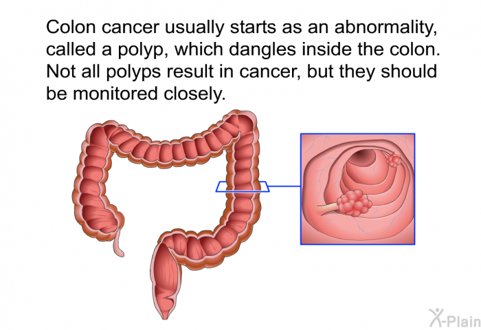 Colon cancer usually starts as an abnormality, called a polyp, which dangles inside the colon. Not all polyps result in cancer, but they should be monitored closely.