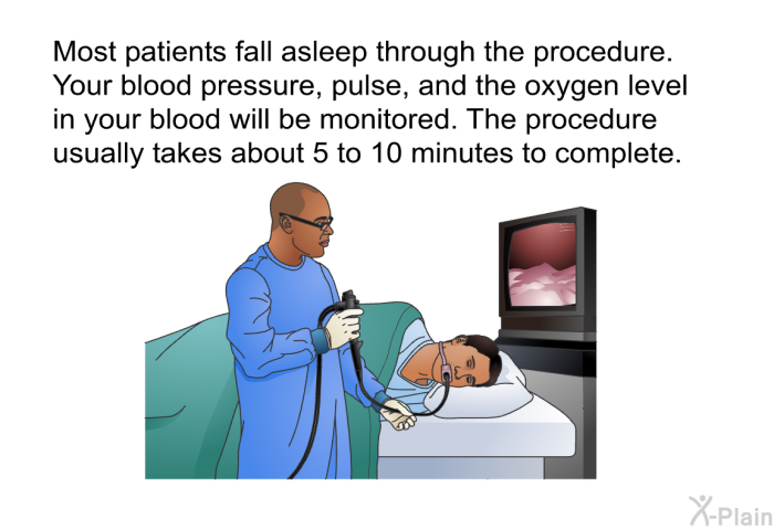 Most patients fall asleep through the procedure. Your blood pressure, pulse, and the oxygen level in your blood will be monitored. The procedure usually takes about 5 to 10 minutes to complete.