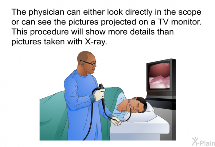The physician can either look directly in the scope or can see the pictures projected on a TV monitor. This procedure will show more details than pictures taken with X-ray.