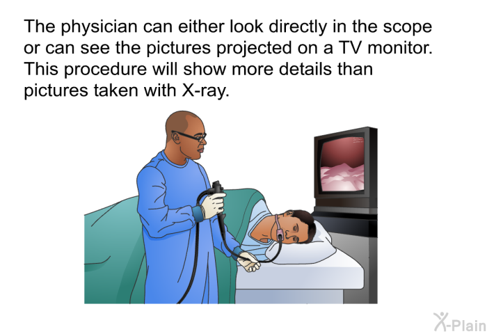 The physician can either look directly in the scope or can see the pictures projected on a TV monitor. This procedure will show more details than pictures taken with X-ray.