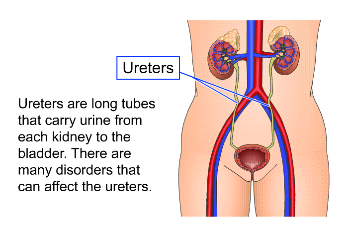 Ureters are long tubes that carry urine from each kidney to the bladder. There are many disorders that can affect the ureters.