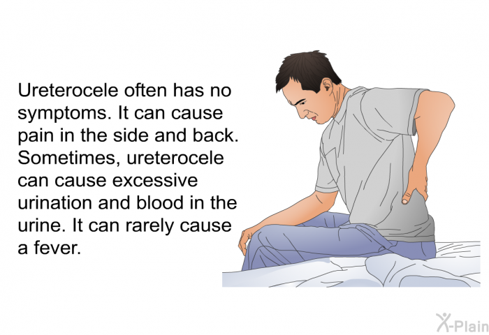 Ureterocele often has no symptoms. It can cause pain in the side and back. Sometimes, ureterocele can cause excessive urination and blood in the urine. It can rarely cause a fever.