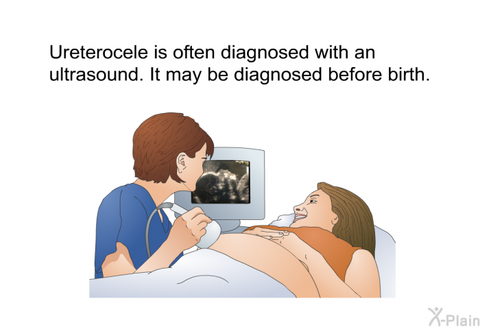 Ureterocele is often diagnosed with an ultrasound. It may be diagnosed before birth.