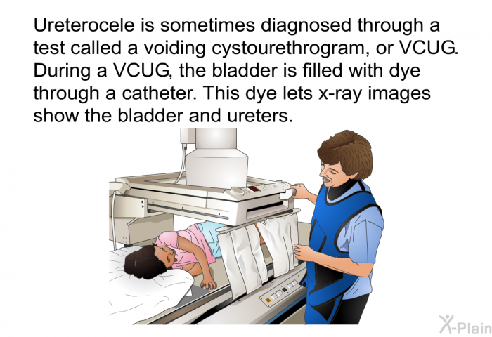 Ureterocele is sometimes diagnosed through a test called a voiding cystourethrogram, or VCUG. During a VCUG, the bladder is filled with dye through a catheter. This dye lets x-ray images show the bladder and ureters.