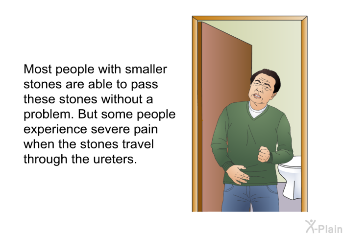 Most people with smaller stones are able to pass these stones without a problem. But some people experience severe pain when the stones travel through the ureters.