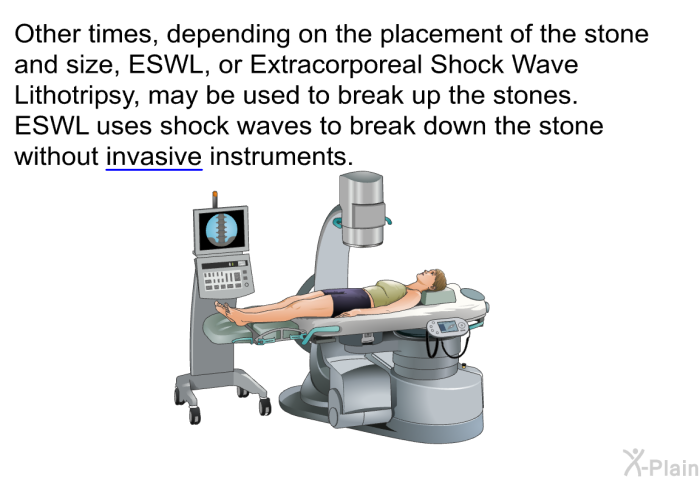 Other times, depending on the placement of the stone and size, ESWL, or Extracorporeal Shock Wave Lithotripsy, may be used to break up the stones. ESWL uses shock waves to break down the stone without invasive instruments.