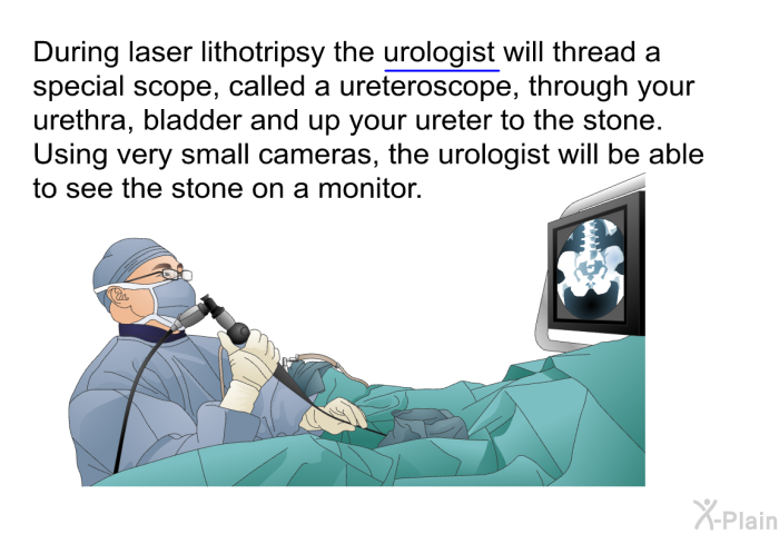During laser lithotripsy the urologist will thread a special scope, called a ureteroscope, through your urethra, bladder and up your ureter to the stone. Using very small cameras, the urologist will be able to see the stone on a monitor.