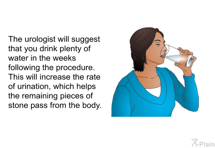 The urologist will suggest that you drink plenty of water in the weeks following the procedure. This will increase the rate of urination, which helps the remaining pieces of stone pass from the body.