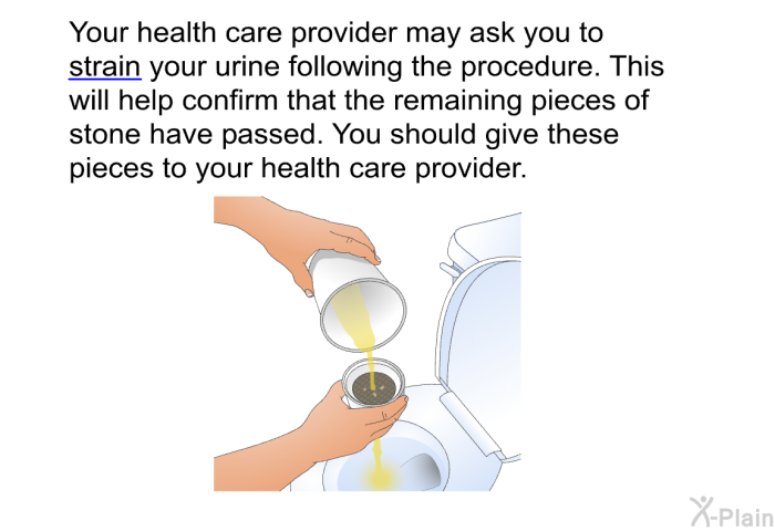 Your health care provider may ask you to strain your urine following the procedure. This will help confirm that the remaining pieces of stone have passed. You should give these pieces to your health care provider.