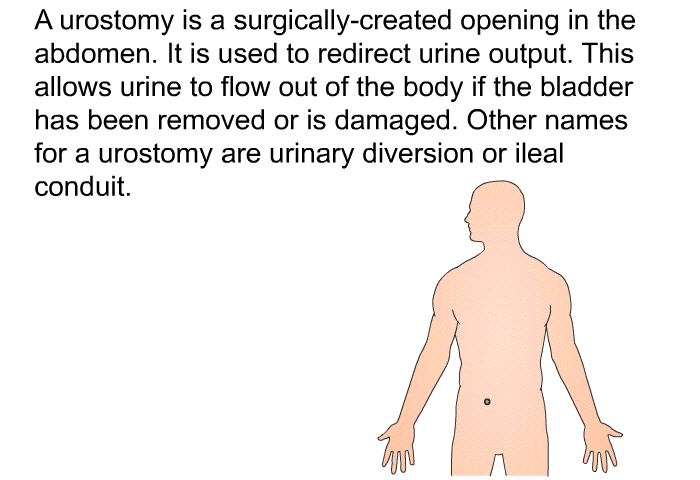 A urostomy is a surgically-created opening in the abdomen. It is used to redirect urine output. This allows urine to flow out of the body if the bladder has been removed or is damaged. Other names for a urostomy are urinary diversion or ileal conduit.